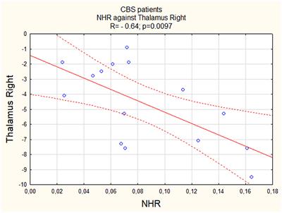 The possible connection between neutrophil-to-high-density lipoprotein ratio and cerebral perfusion in clinically established corticobasal syndrome: a pilot study